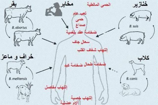 طريقة انتقال المرض ومضاعفات الإصابة
